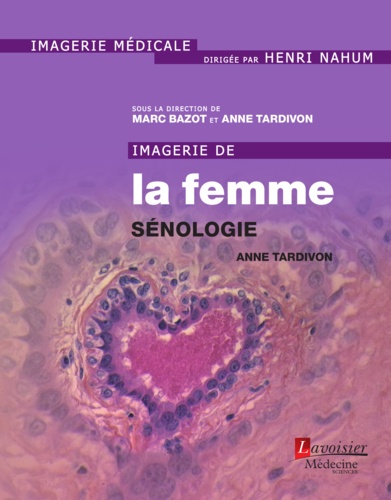 Anne Tardivon - Imagerie de la femme : sénologie.