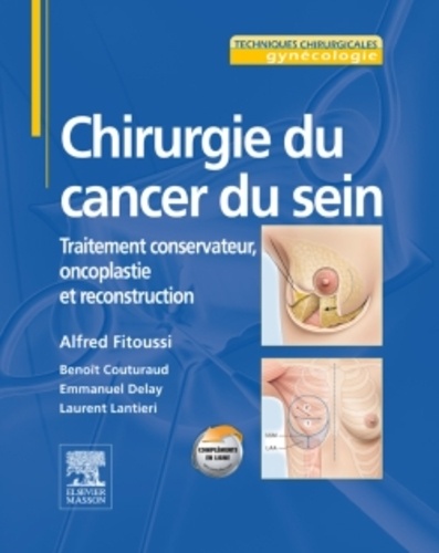 Annie Fitoussi et Benoît Couturaud - Chirurgie du cancer du sein.