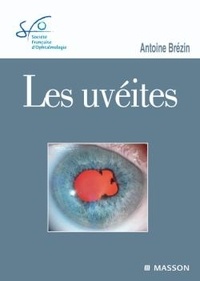 Antoine Brézin - Les uvéites.