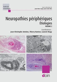 Neuropathies périphériques