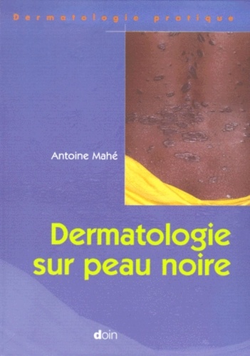 Antoine Mahé - Dermatologie Sur Peau Noire.