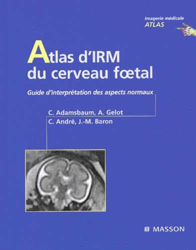 Antoinette Gelot et Christine André - Atlas D'Irm Du Cerveau Foetal. Guide D'Interpretation Des Aspetcs Normaux.
