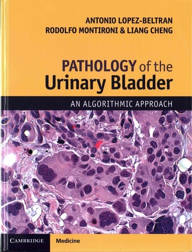 Antonio Lopez Beltran - Pathology of the Urinary Bladder.