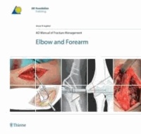 AO Manual of Fracture Management - Elbow & Forearm.