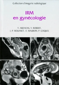 IRM en gynécologie