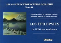 Arielle Crespel et Philippe Gélisse - Atlas d'électroencéphalographie - Tome 2, Les épilepsies, de l'EEG aux syndromes.