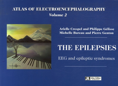 Arielle Crespel et Philippe Gélisse - Atlas of Electroencephalography - Volume 2, The Epilepsies, EEG and Epileptic Syndromes.