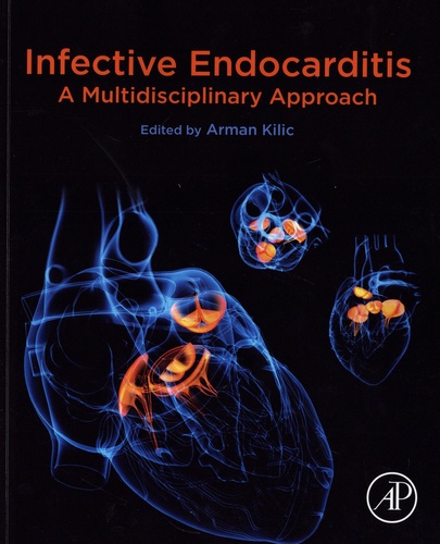 Infective Endocarditis. A multidisciplinary Approach