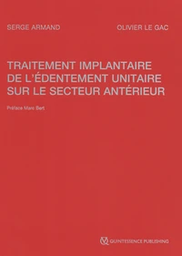 Traitement implantaire de l'édentement unitaire sur le secteur antérieur