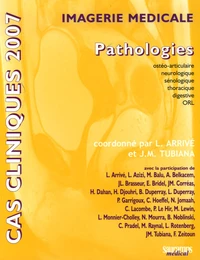 Imagerie médicale
