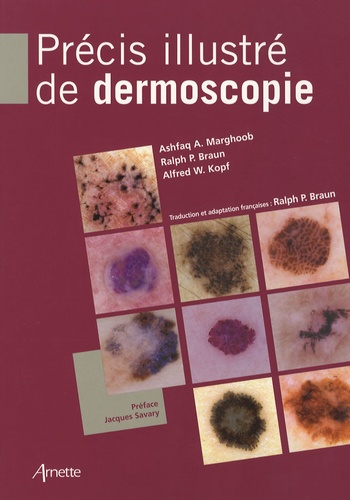 Ashfaq A. Marghoob et Ralph-P Braun - Précis illustré de dermoscopie.