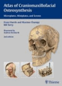 Atlas of Craniomaxillofacial Osteosynthesis - Miniplates, Microplates, and Screws.