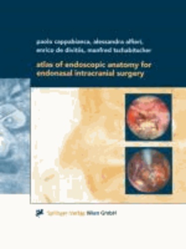 Atlas of Endoscopic Anatomy for Endonasal... de Springer - Livre - Decitre
