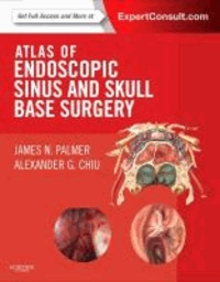 Atlas of Endoscopic Sinus and Skull Base Surgery - Expert Consult - Online and Print.