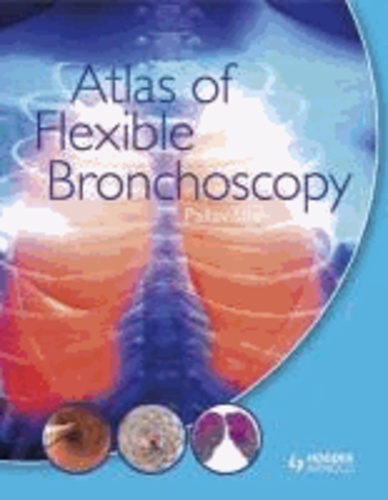 Atlas of Flexible Bronchoscopy.
