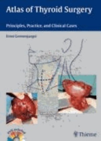 Atlas of Thyroid Surgery - Principles, Practice, and Clinical Cases.