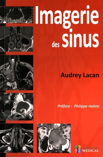 Audrey Lacan - Imagerie des sinus.