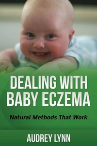 Dealing With Baby Eczema