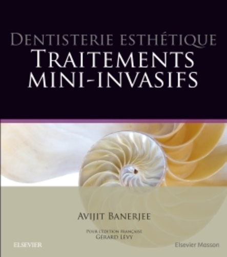Avijit Banerjee et Gérard Lévy - Dentisterie esthétique - Traitements mini-invasifs.