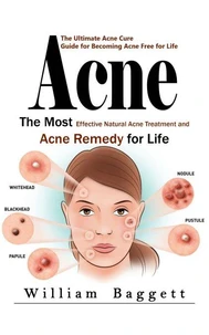 Acne: The Ultimate Acne Cure Guide for Becoming Acne Free for Life (The Most Effective Natural Acne Treatment and Acne Remedy for Life)