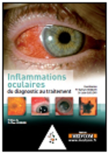 Bahram Bodaghi et Julie Gueudry - L'inflammation oculaire.