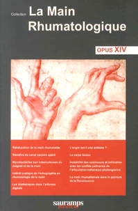 La main rhumatologique