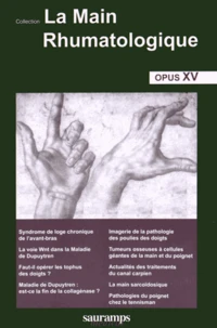 La main rhumatologique