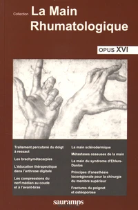 La main rhumatologique