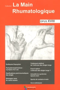 La main rhumatologique
