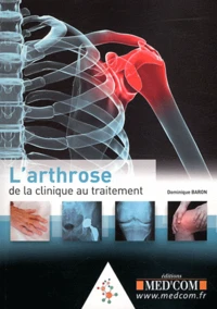 L'arthrose