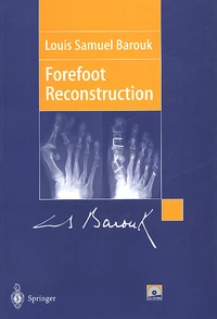 Forefoot Reconstruction. With Cd-Rom