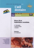 R Tordjman et V Bensoussan - Sinus Lift et implantation immédiate. 1 DVD