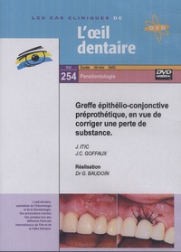 Gérard Baudoin - Greffe épithélio-conjonctive préprothétique, en vue de corriger une perte de substance. 1 DVD