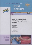 Gérard Baudoin - Mise en charge rapide d'un bridge implantaire Procera. 1 DVD