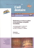 Jean-Marie Rignon-Bret et Philippe Lesclous - Réalisation et mise en place d'une prothèse complète immédiate. 1 DVD