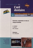 Bernard Cannas et Luc Gillot - Extraction, implantation et mise en charge immédiate. 1 DVD