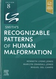 Kenneth Lyons Jones et Marilyn Crandall Jones - Smith's Recognizable Patterns of Human Malformation.
