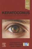 Luis Izquierdo et Maria Henriquez - Keratoconus - Diagnosis and Management.