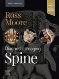 Ross Moore - Diagnostic Imaging - Spine.