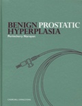 Perinchery Narayan - Benign Prostatic Hyperplasia.
