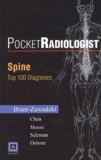 Michael Brant-Zawadzki - Spine. Top 100 Diagnoses.