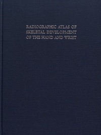 William Walter Greulich et S Idell Pyle - Radiographic Atlas of Skeletal Development of the Hand and Wrist.