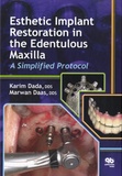 Karim Dada et Marwan Daas - Esthetic Implant Restoration in the Edentulous Maxilla - A Simplified Protocol.