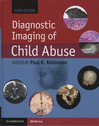 Paul-K Kleinman - Diagnostic Imaging of Child Abuse.