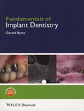 Gerard Byrne - Fundamentals of Implant Dentistry.