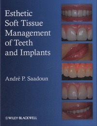 André P. Saadoun - Esthetic Soft Tissue Management of Teeth and Implants.