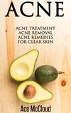  Ace McCloud - Acne: Acne Treatment: Acne Removal: Acne Remedies For Clear Skin.