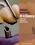 Jacques Malet et Francis Mora - Implant Dentistry at a Glance.