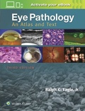 Ralph C. Eagle - Eye Pathology - An Atlas and Text.