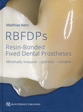 Matthias Kern - RBFDPs - Resin-Bonded Fixed Dental Prostheses - Minimally invasive - esthetic - reliable.